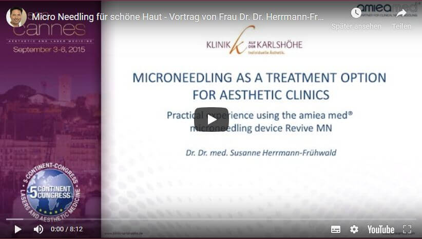 Microneedling, Klinik auf der Karlshöhe, Stuttgart, Dr. Fitz